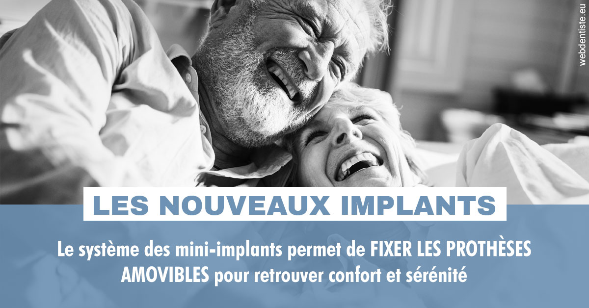 https://dr-valerie-travert.chirurgiens-dentistes.fr/Les nouveaux implants 2