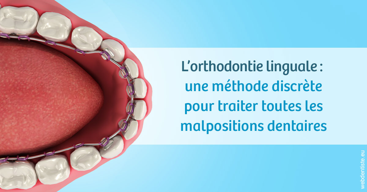 https://dr-valerie-travert.chirurgiens-dentistes.fr/L'orthodontie linguale 1