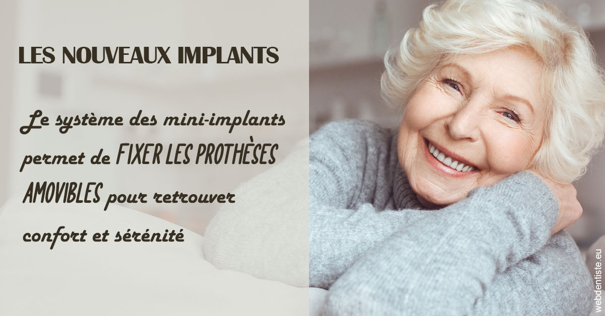 https://dr-valerie-travert.chirurgiens-dentistes.fr/Les nouveaux implants 1