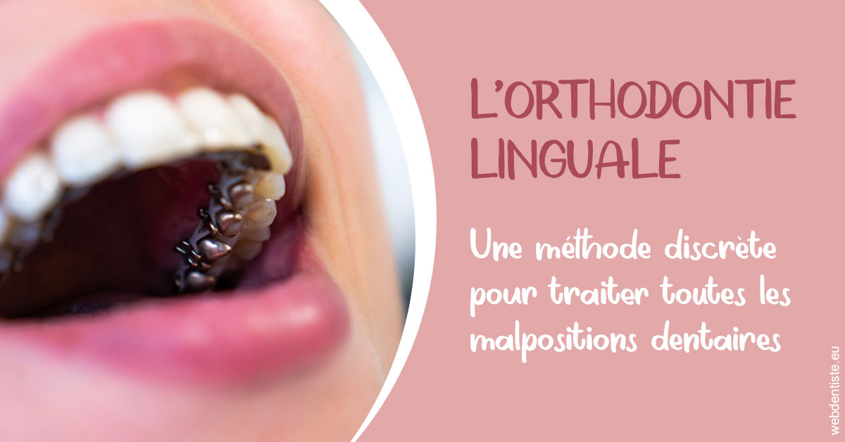 https://dr-valerie-travert.chirurgiens-dentistes.fr/L'orthodontie linguale 2