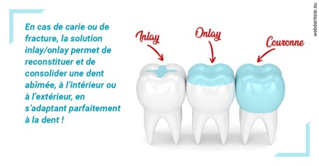 https://dr-valerie-travert.chirurgiens-dentistes.fr/L'INLAY ou l'ONLAY