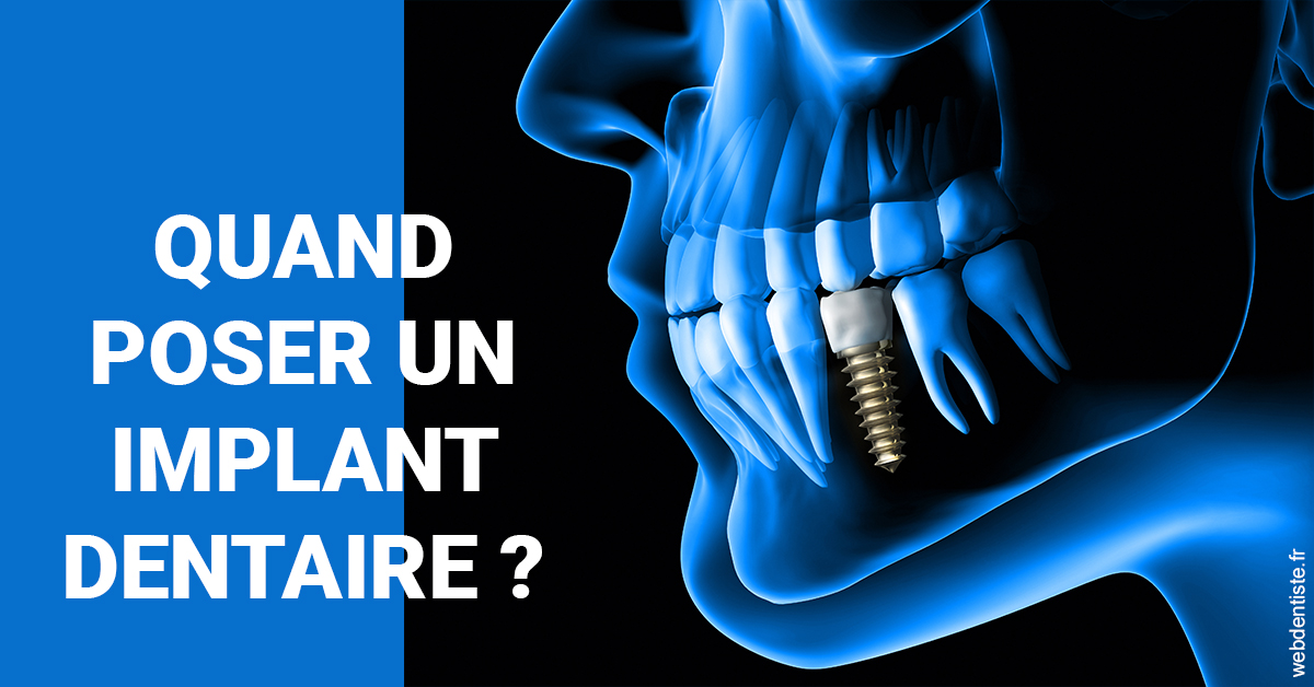https://dr-valerie-travert.chirurgiens-dentistes.fr/Les implants 1