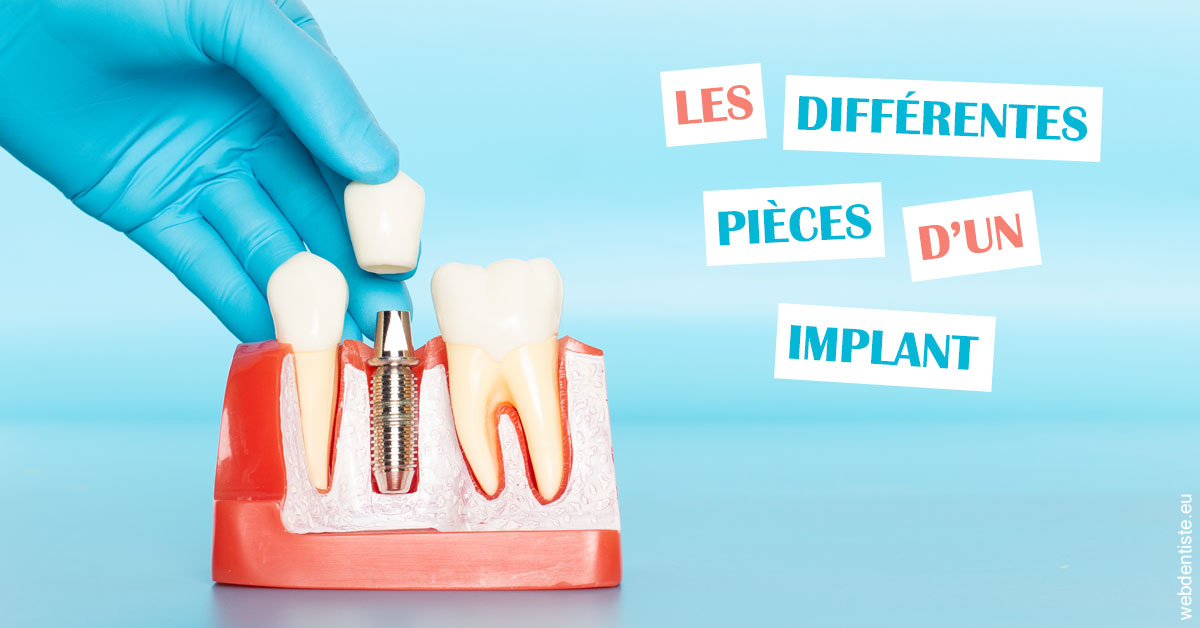 https://dr-valerie-travert.chirurgiens-dentistes.fr/Les différentes pièces d’un implant 2