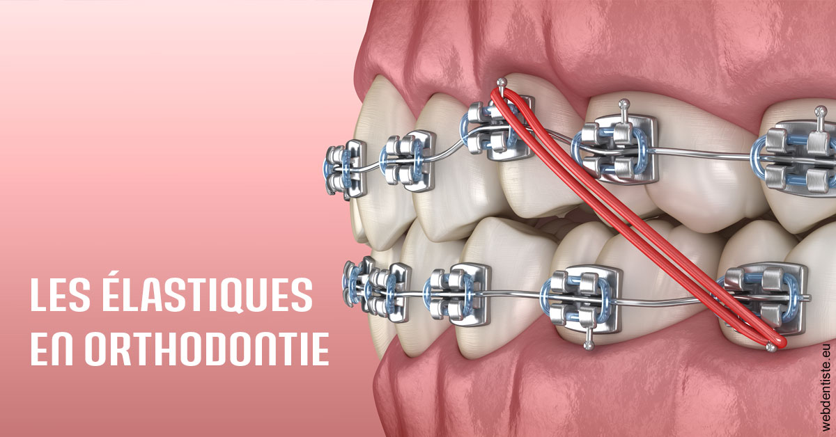 https://dr-valerie-travert.chirurgiens-dentistes.fr/Elastiques orthodontie 2
